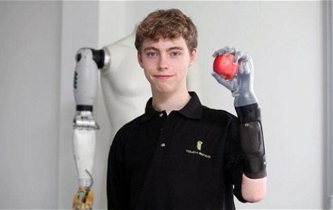 F1 Hayranı Gencin Biyonik Koluna Mercedes GP Sponsor Oldu