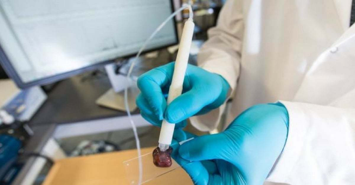 MasSpec Pen Kanser Hücrelerini 10 Saniyede ve Eksiksiz Olarak Tespit Edebiliyor [SXSW 2018]